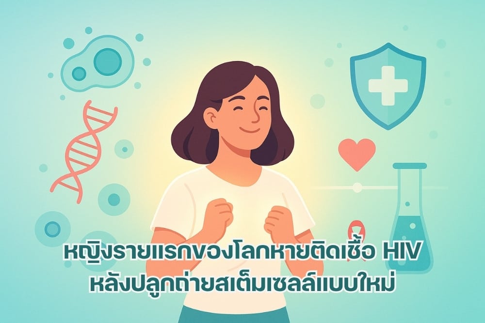 ผู้หญิงรายแรกที่มีรายงาน HIV อยู่ในภาวะสงบหลังปลูกถ่ายเลือดสายสะดือ
